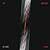 Juicebox, The Strokes, Pop světový - Monofonní melodie na mobil - Ikonka